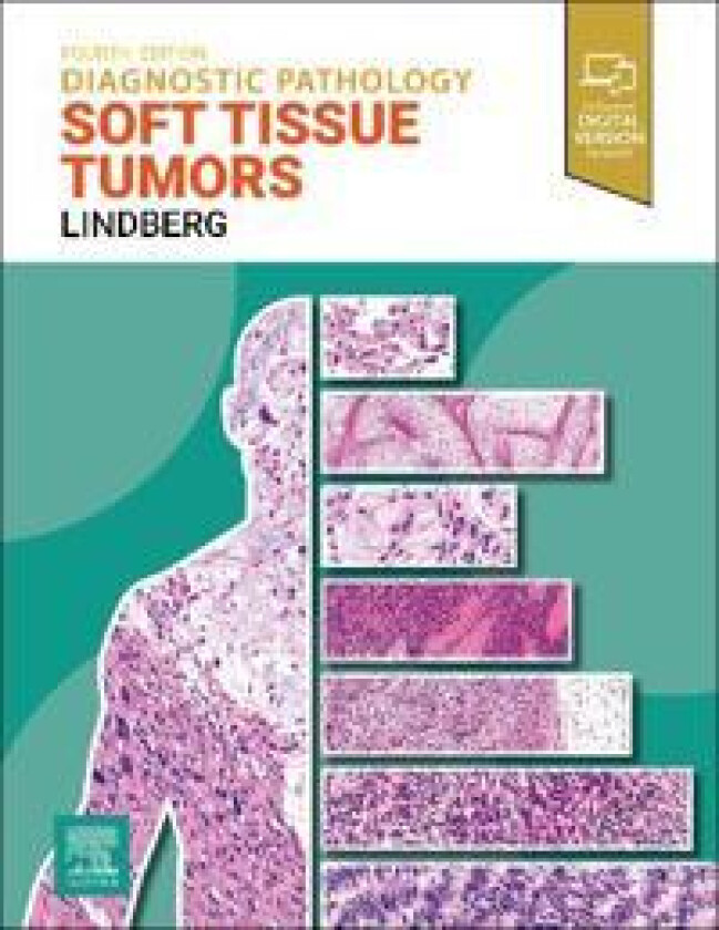 Bilde av Diagnostic Pathology: Soft Tissue Tumors