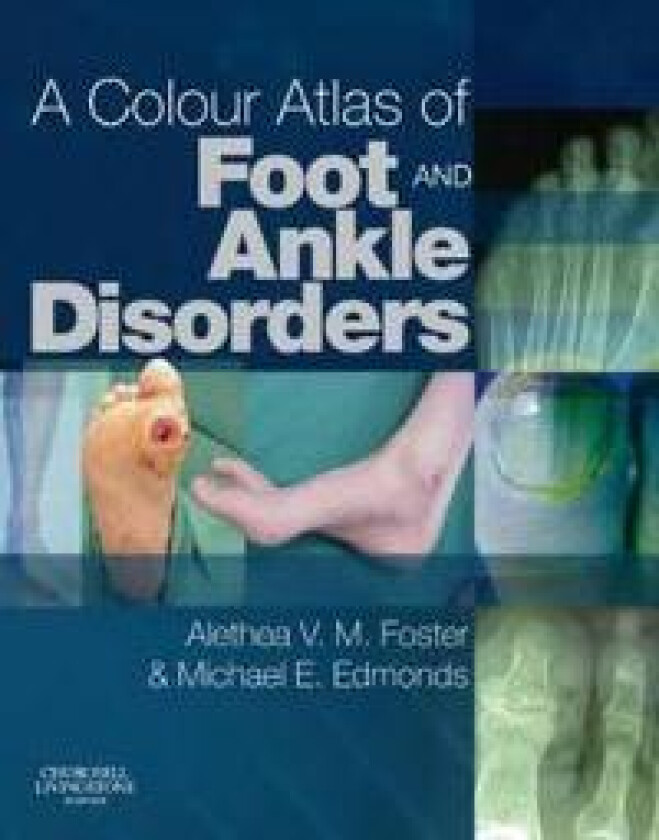 A Colour Atlas of Foot and Ankle Disorders