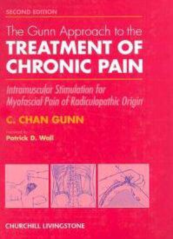 The Gunn Approach to the Treatment of Chronic Pain