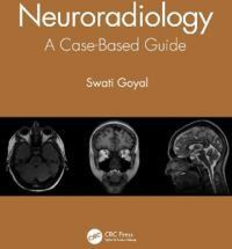 Neuroradiology