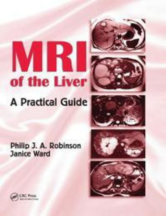 MRI of the Liver