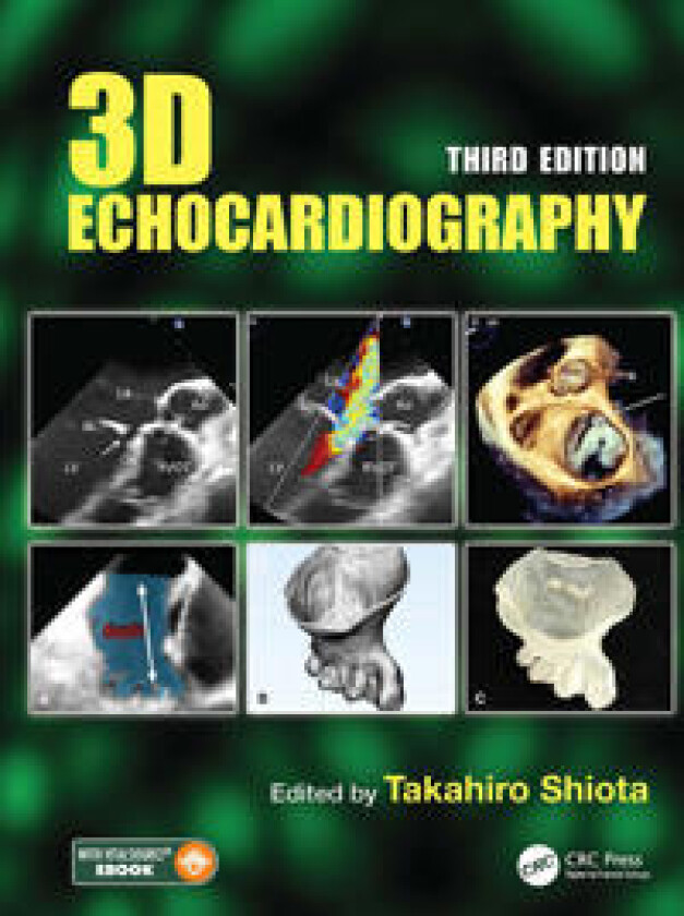 3D Echocardiography