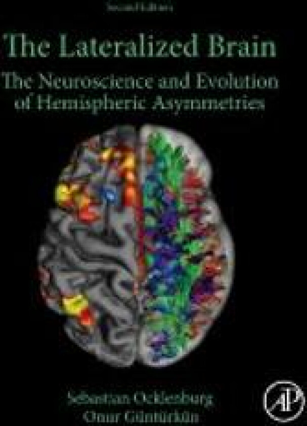 The Lateralized Brain