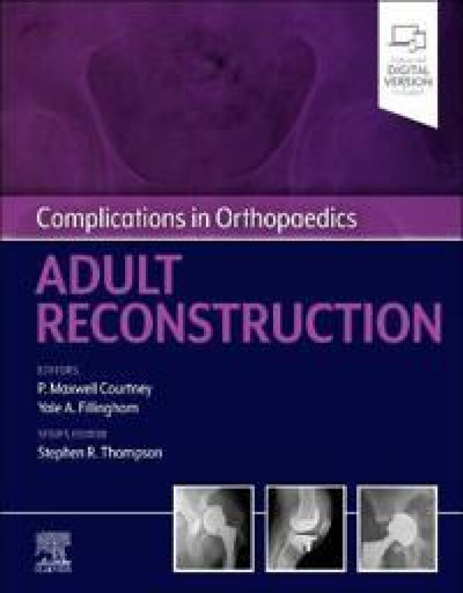 Complications in Orthopaedics: Adult Reconstruction