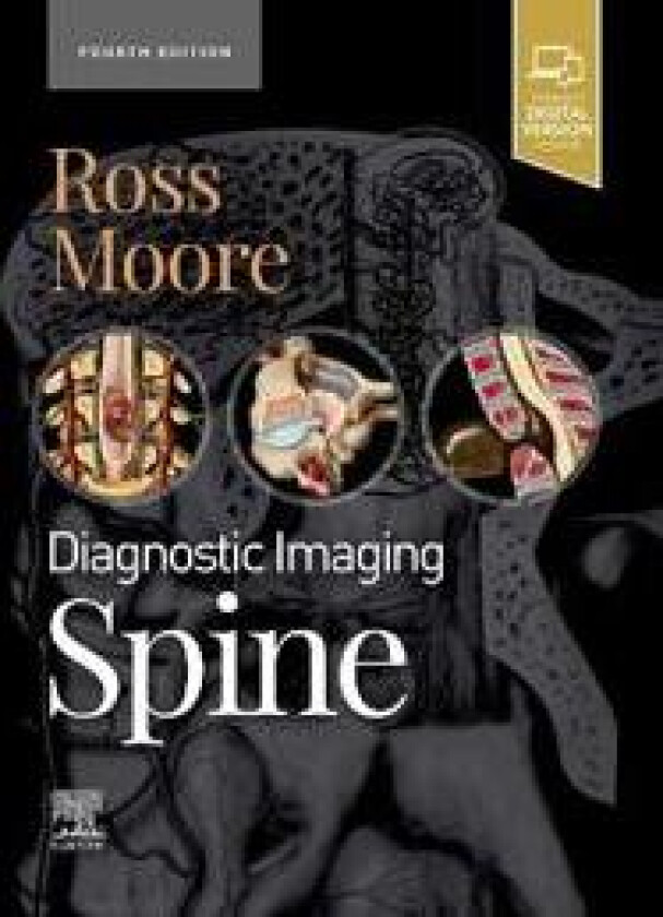 Diagnostic Imaging: Spine