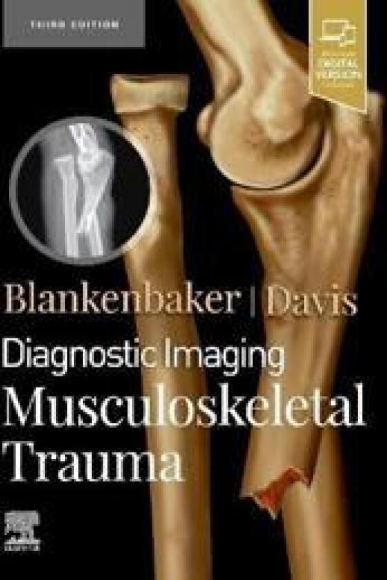 Diagnostic Imaging: Musculoskeletal Trauma