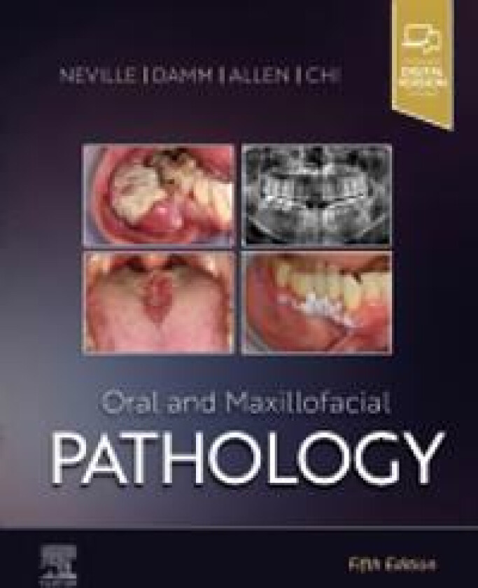 Oral and Maxillofacial Pathology