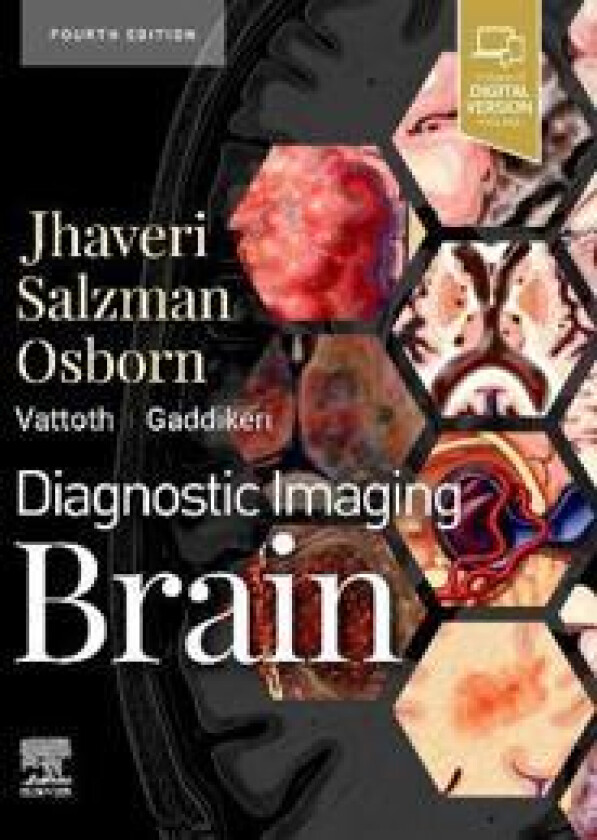 Diagnostic Imaging: Brain