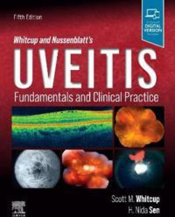 Whitcup and Nussenblatt's Uveitis