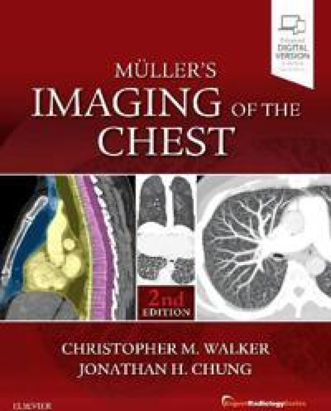 Muller's Imaging of the Chest