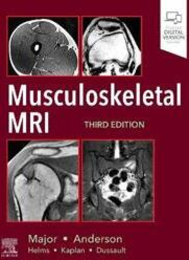 Musculoskeletal MRI