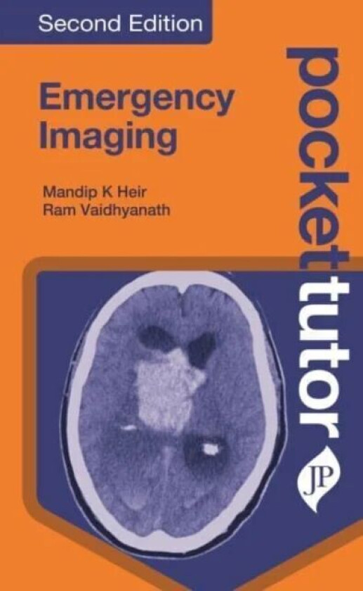 Pocket Tutor Emergency Imaging av Mandip K. Heir, Ram Vaidhyanath
