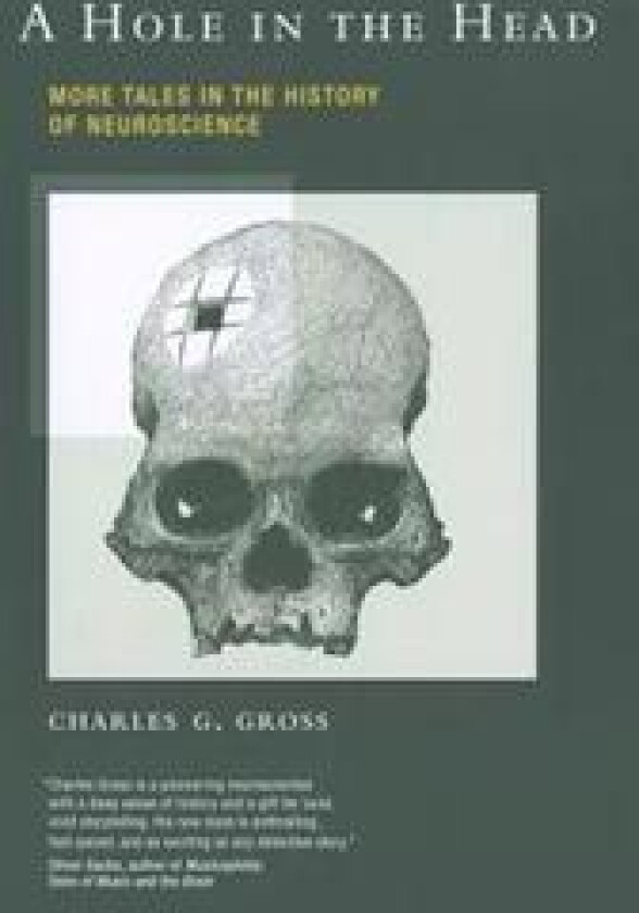 A Hole in the Head