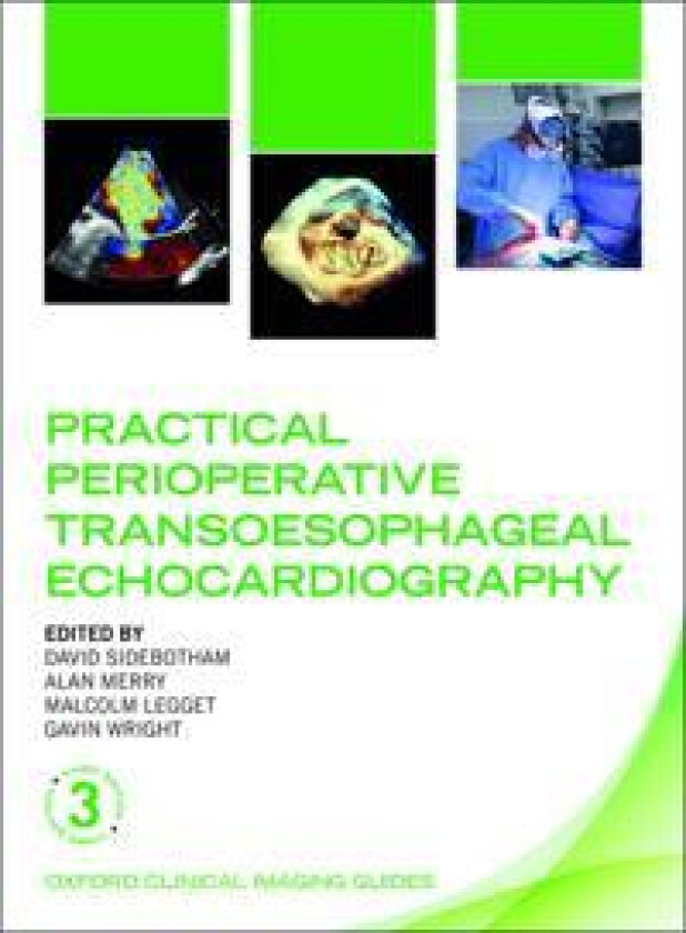 Practical Perioperative Transoesophageal Echocardiography