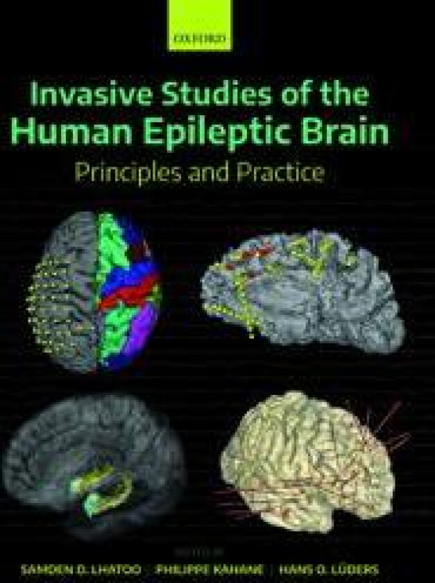 Invasive Studies of the Human Epileptic Brain