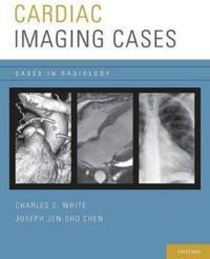 Cardiac Imaging Cases