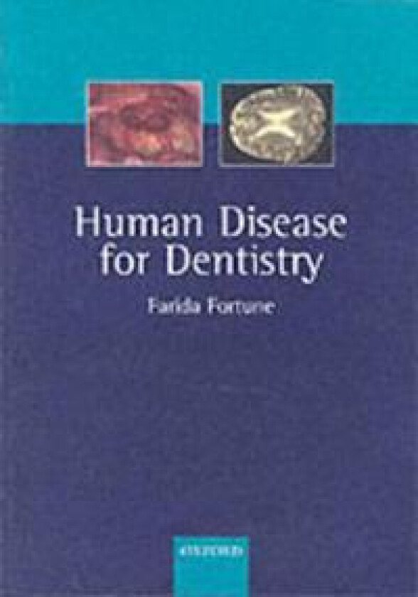 Human Disease for Dentistry