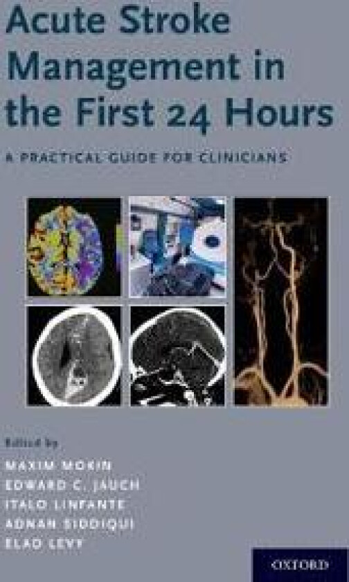 Acute Stroke Management in the First 24 Hours