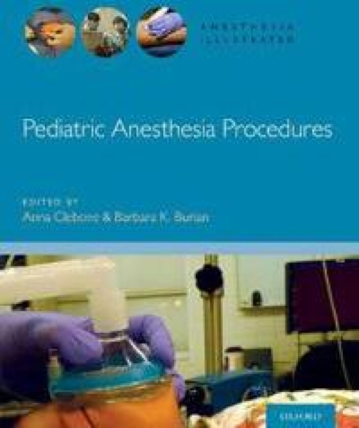 Pediatric Anesthesia Procedures