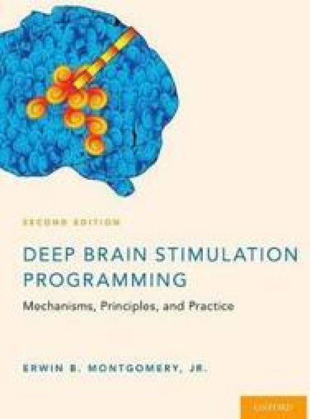Deep Brain Stimulation Programming