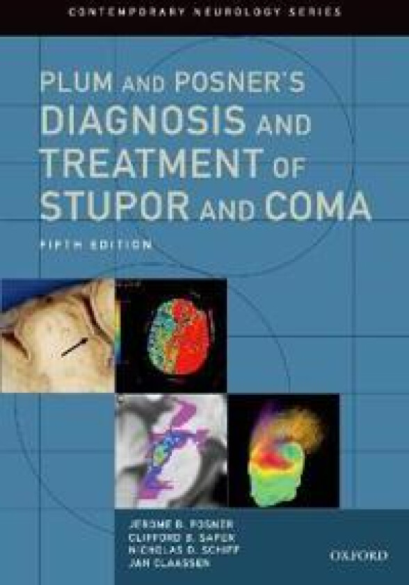 Plum and Posner's Diagnosis and Treatment of Stupor and Coma
