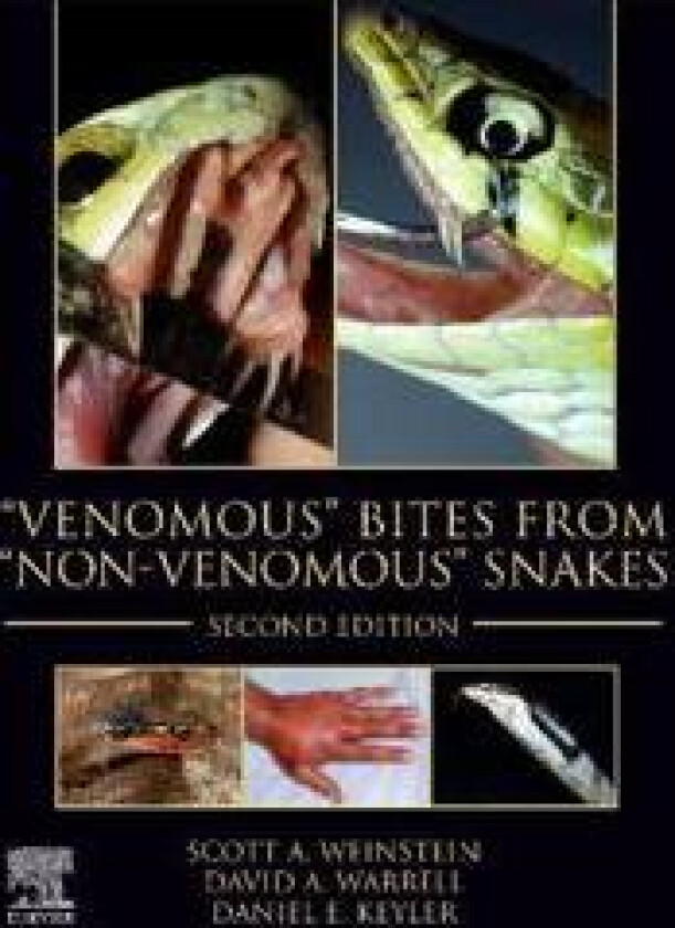 'Venomous' Bites from 'Non-Venomous' Snakes