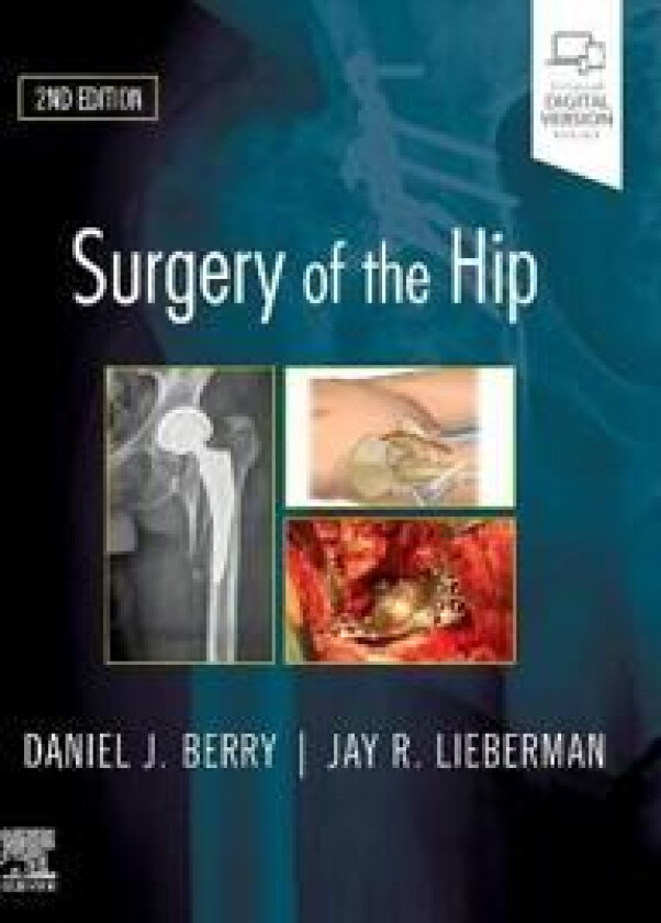 Surgery of the Hip