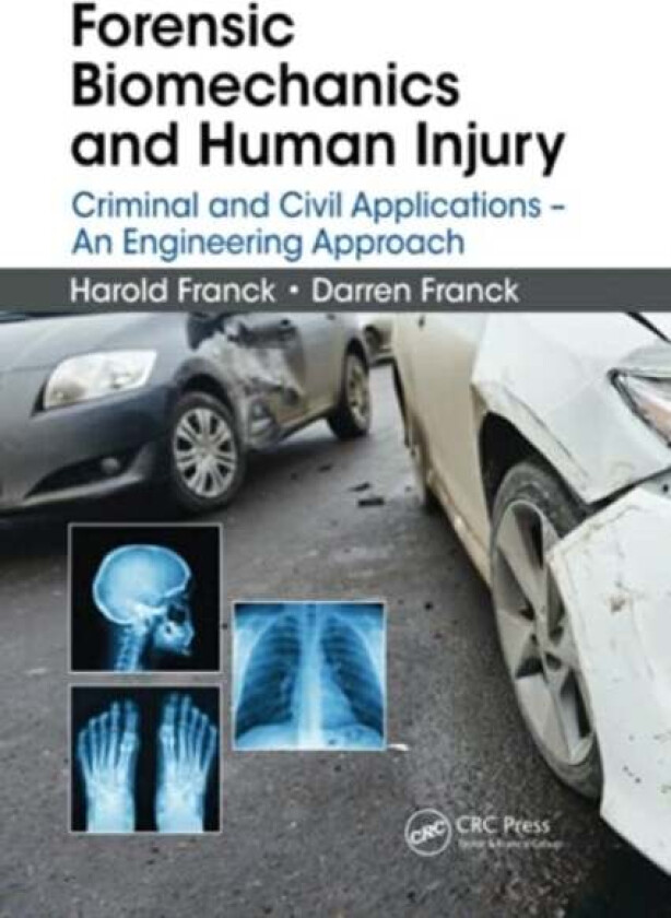 Forensic Biomechanics and Human Injury av Harold Franck, Darren Franck