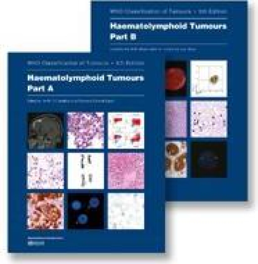 Bilde av The WHO Classification of Tumours Haematolymphoid Tumours (Volume 11) 5th edition