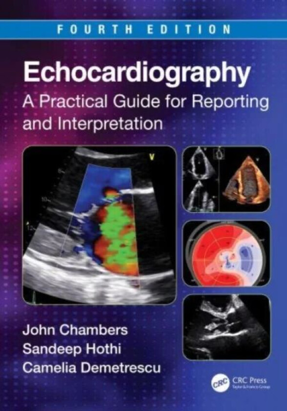 Echocardiography av Camelia (Guy's and St Thomas' Hospitals London UK) Demetrescu, Sandeep S. (University of Birmingham UK) Hothi, John (Guy