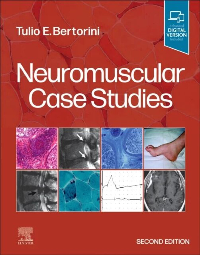 Neuromuscular Case Studies av Tulio E. (Professor of Neurology and Pa Bertorini