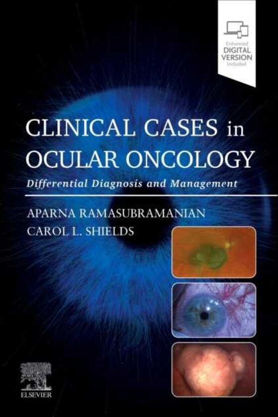 Clinical Cases in Ocular Oncology Differential Diagnosis and Management