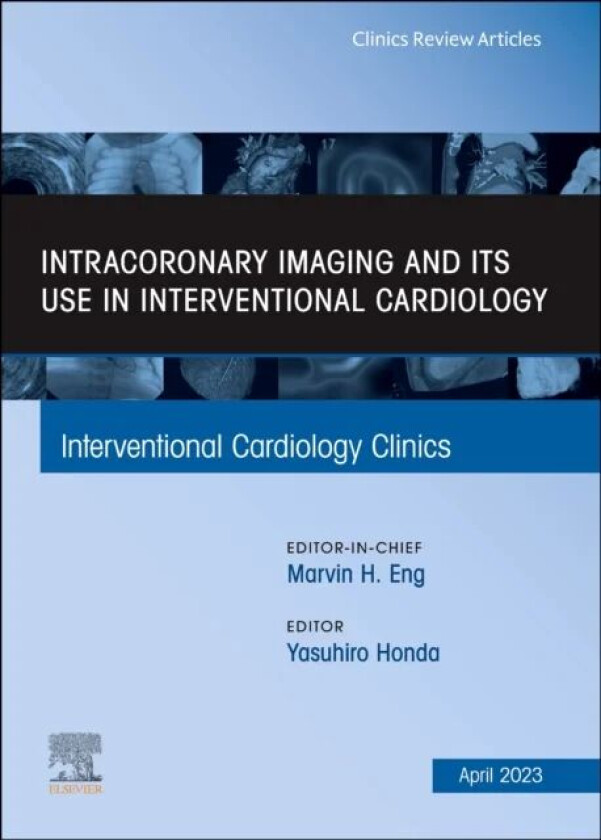 Intracoronary Imaging and its use in Interventional Cardiology, An Issue of Interventional Cardiolog