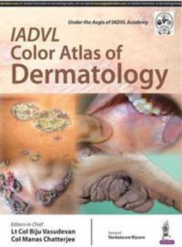 IADVL Color Atlas of Dermatology