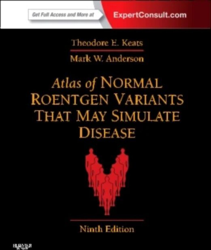 Atlas of Normal Roentgen Variants That May Simulate Disease av Theodore E. (Alumni Professor of Radiology Department of Radiology University of Virgin