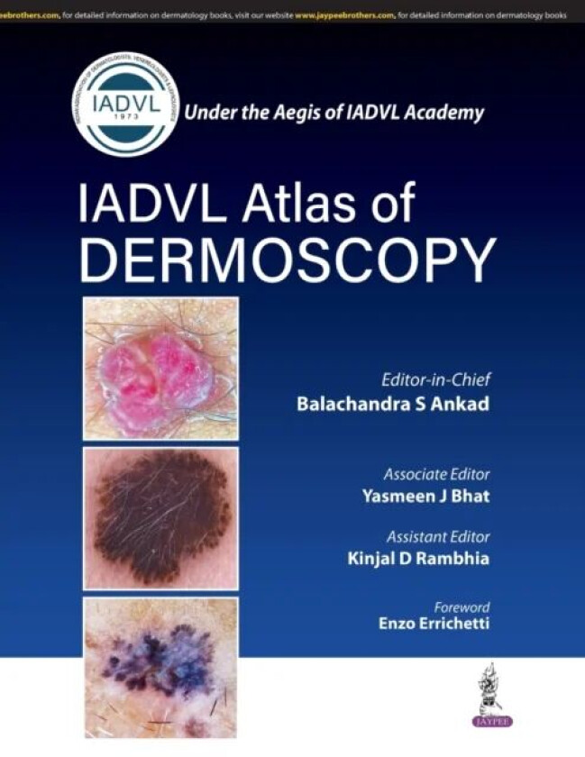 Atlas of Dermoscopy av Balachandra S Ankad, Yasmeen J Bhat, Kinjal D Rambhia