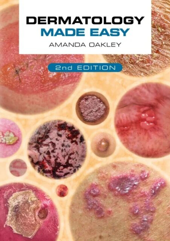Dermatology Made Easy, second edition av Amanda (Adjunct Associate Professor Department of Medicine University of Auckland New Zealand) Oakley