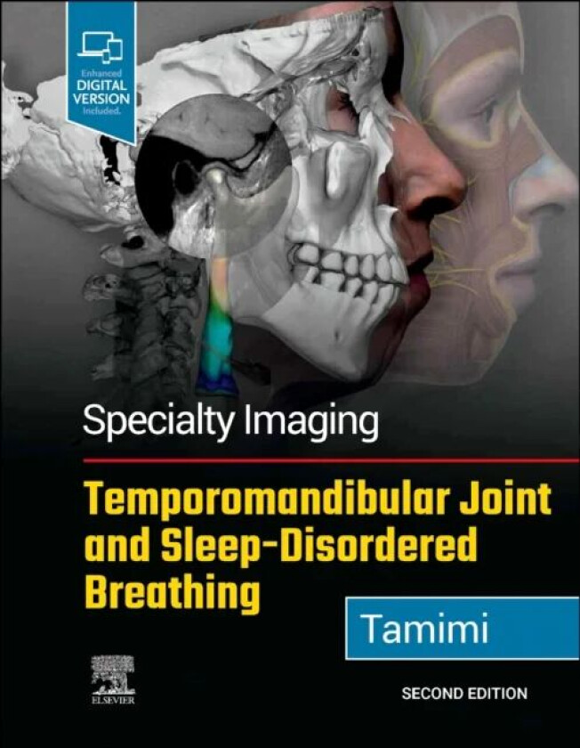 Bilde av Specialty Imaging: Temporomandibular Joint and Sleep-Disordered Breathing av Dania Tamimi