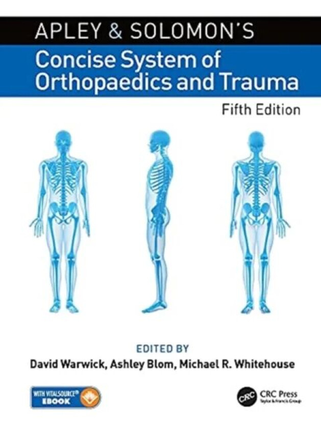 Apley and Solomon¿s Concise System of Orthopaedics and Trauma