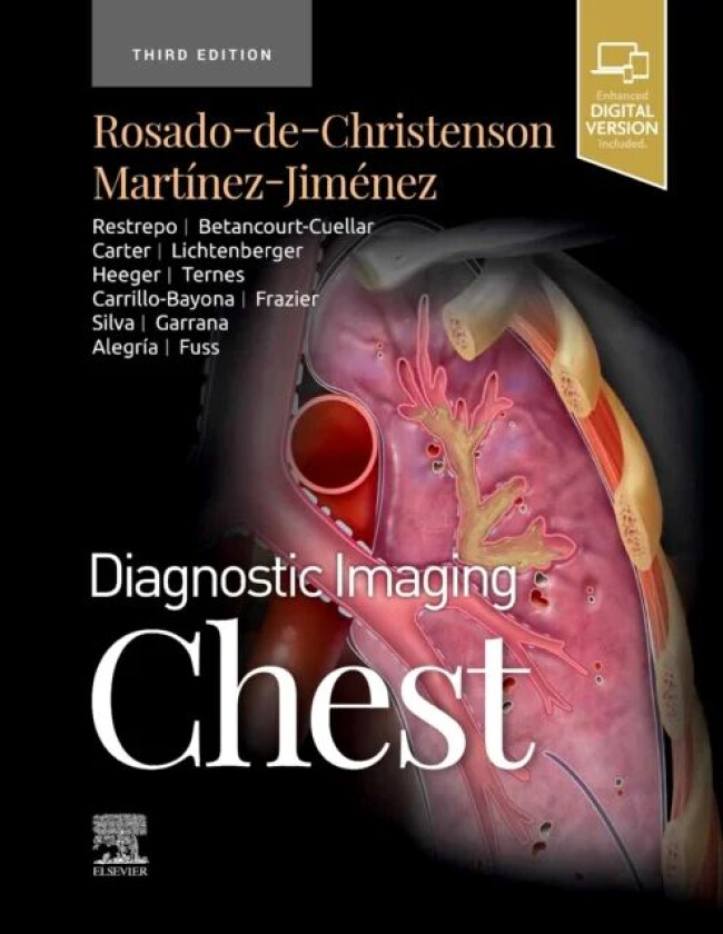 Diagnostic Imaging: Chest av Melissa L. MD FACR (Section Chief Thoracic Radiology Department of Radiology Saint Luke's Hospital of Kansas City Pr