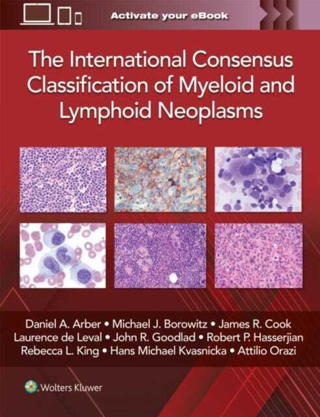 Bilde av The International Consensus Classification of Myeloid and Lymphoid Neoplasms
