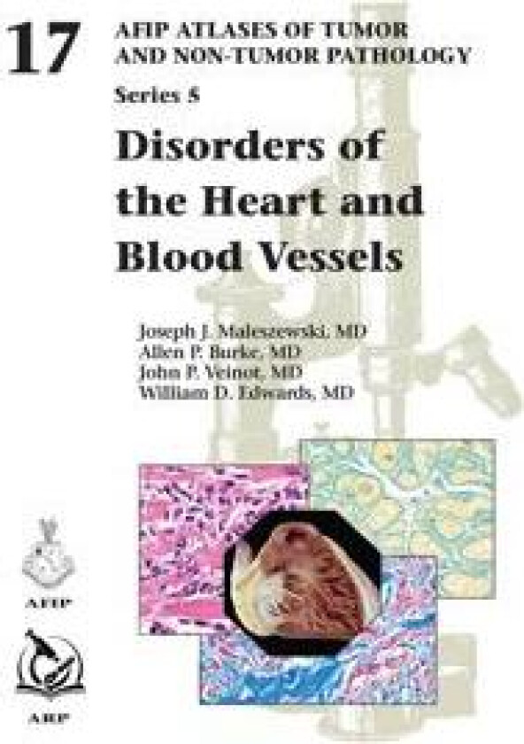 Disorders of the Heart and Blood Vessels