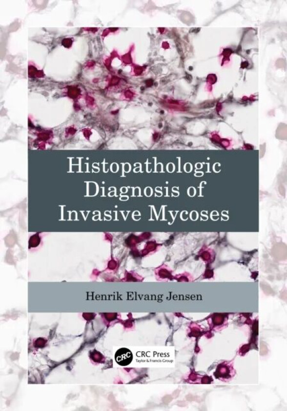Histopathologic Diagnosis of Invasive Mycoses av Henrik Elvang (University of Copenhagen Denmark) Jensen