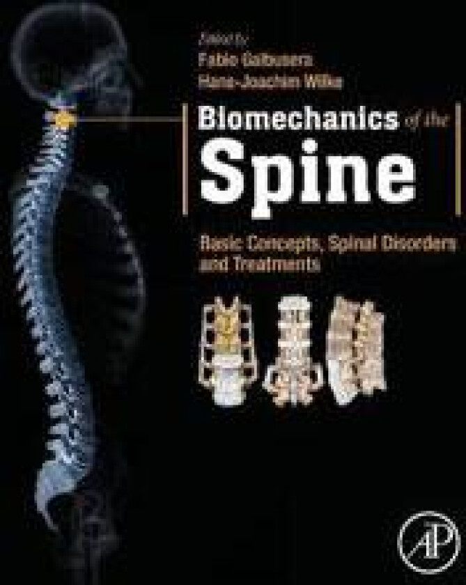 Biomechanics of the Spine
