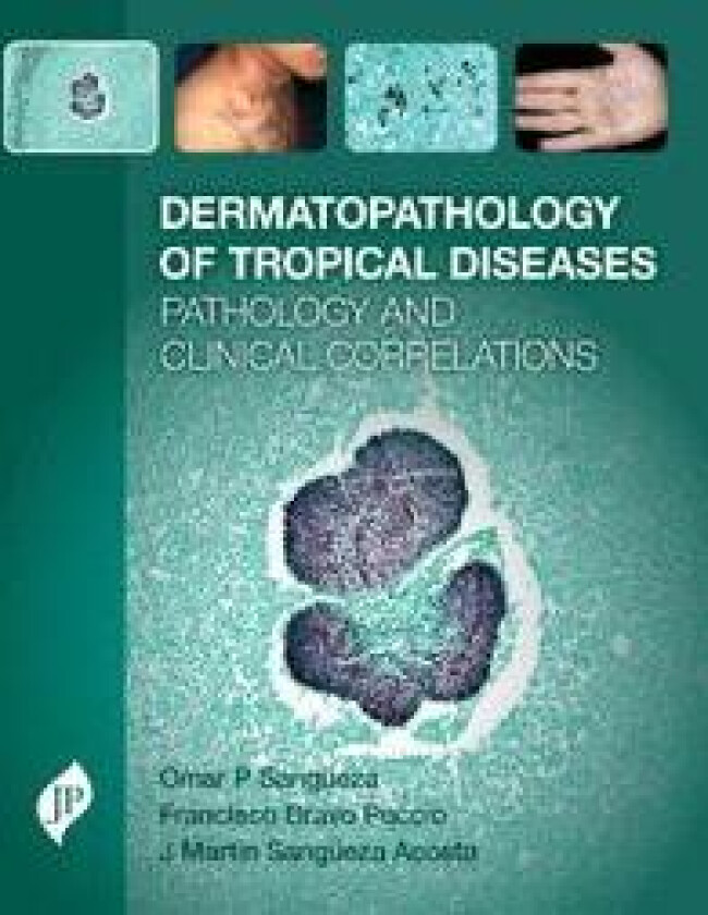 Bilde av Dermatopathology of Tropical Diseases