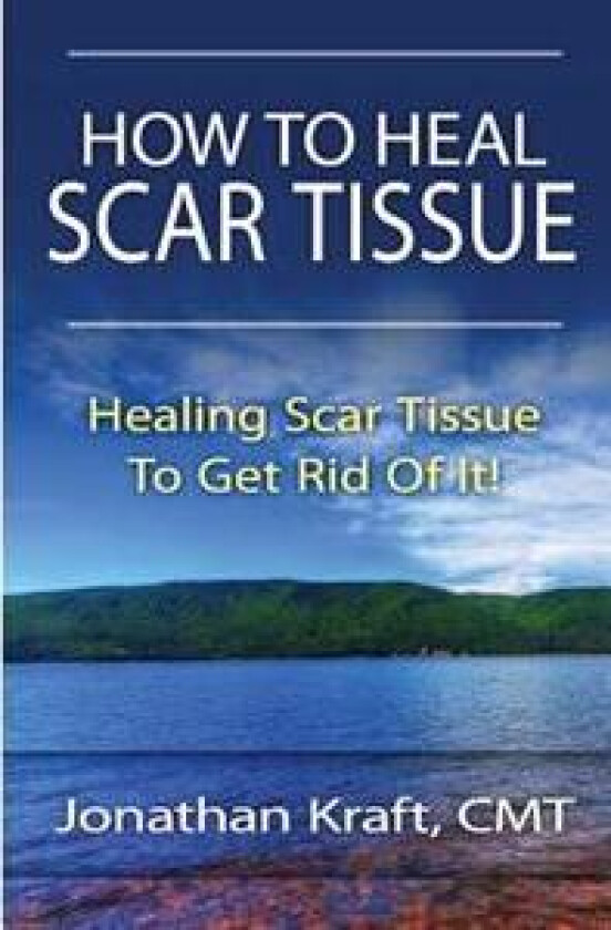 How to Heal Scar Tissue: How to Heal Your Own Scar Tissue and Get Rid of It!