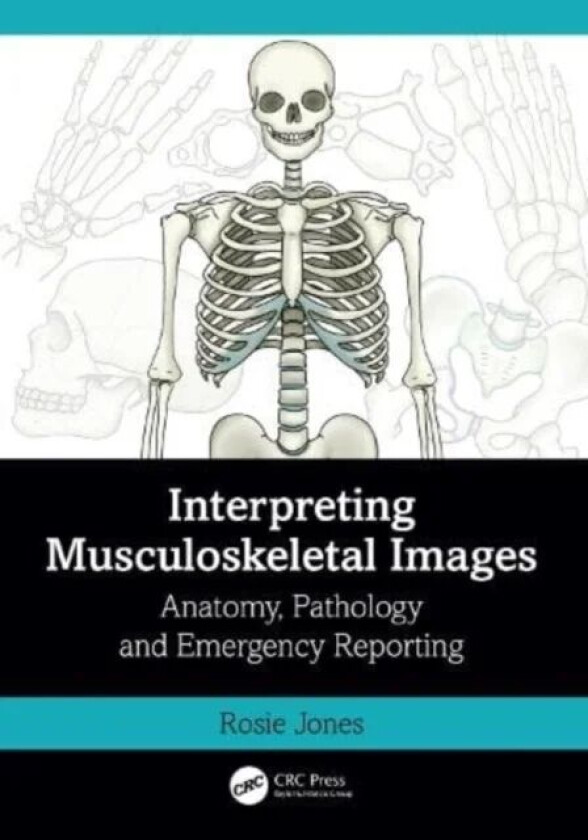 Interpreting Musculoskeletal Images av Rosie (Uni Hospitals of North Midlands) Jones