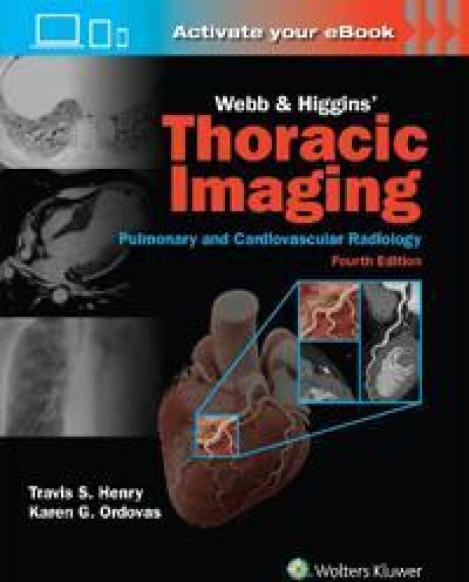 Webb & Higgins Thoracic Imaging: Print + eBook with Multimedia