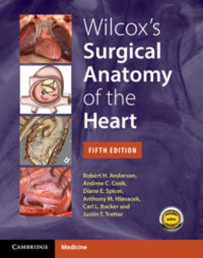 Bilde av Wilcox's Surgical Anatomy of the Heart