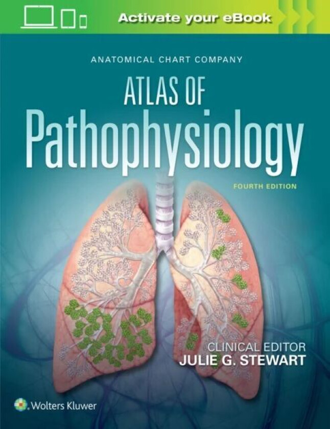 Anatomical Chart Company Atlas of Pathophysiology av Julie Stewart